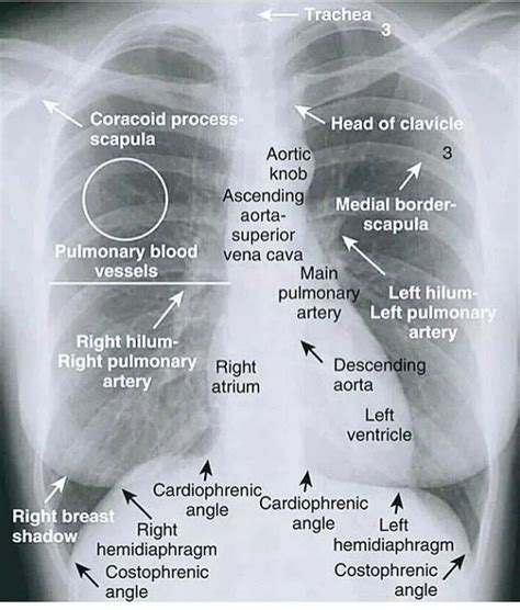 chest traduzione|chest x ray italiano.